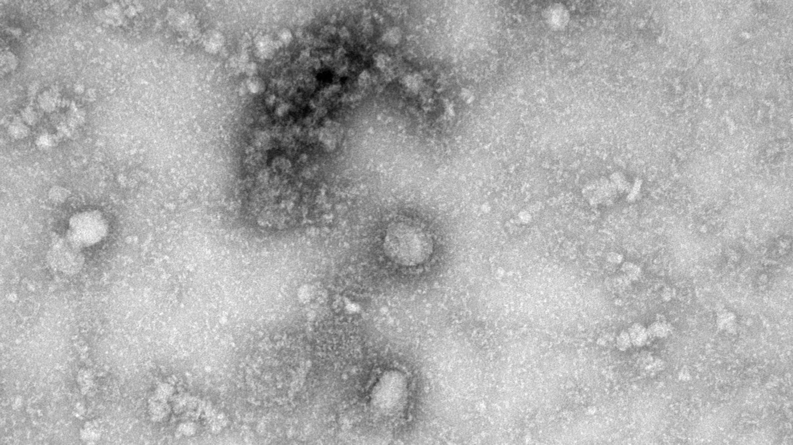 “Everything incomprehensible is scary”: FMBA infectious disease specialist told about the oddities of coronavirus