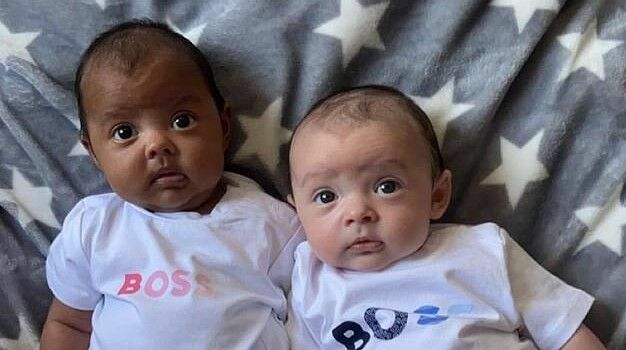 Genes joked: the British gave birth to twins with different skin color