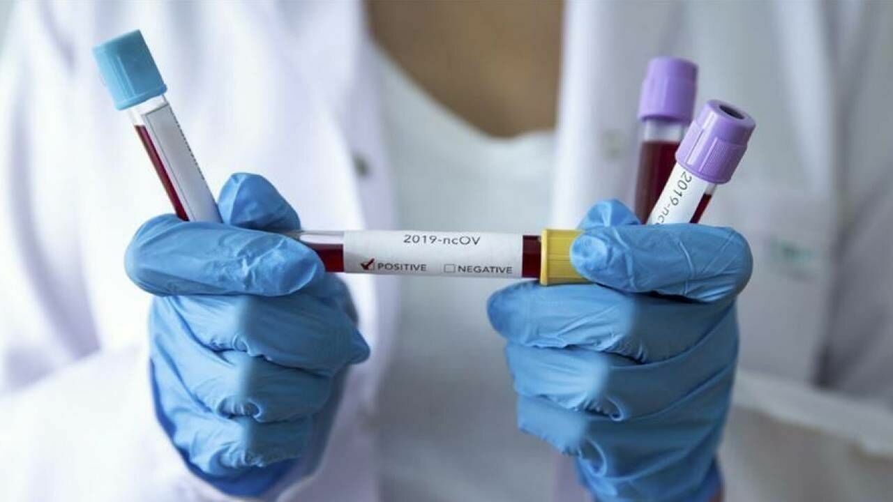 People living with the diseased with COVID-19, will be tested in Moscow twice