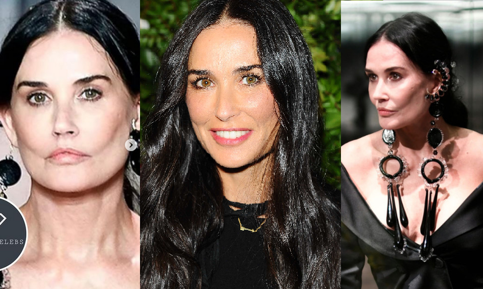 New victim of surgeons: fans of Demi Moore mourn her appearance
