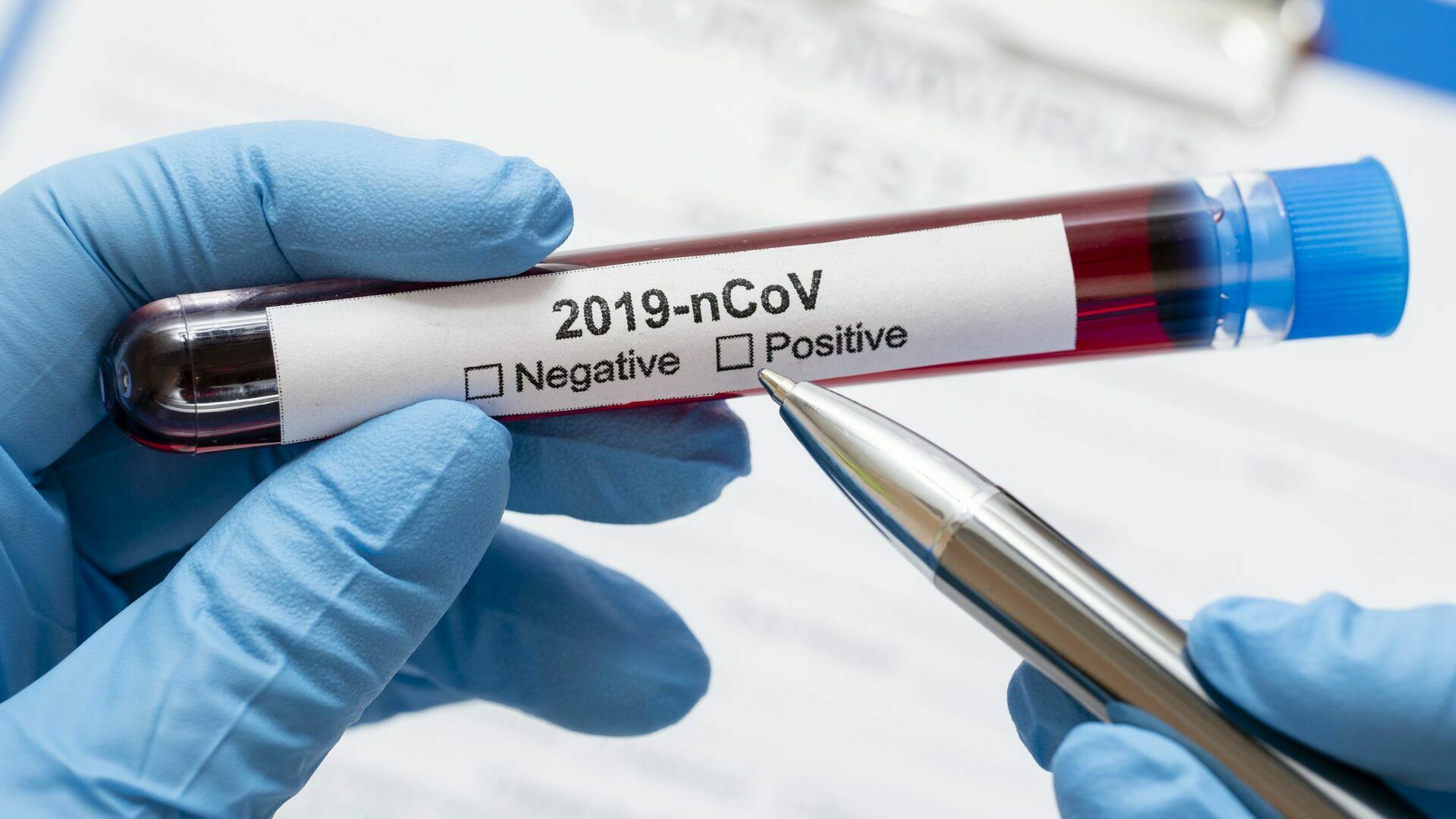 "Invitro": tests for coronavirus can now be implemented by yourself and without leaving home