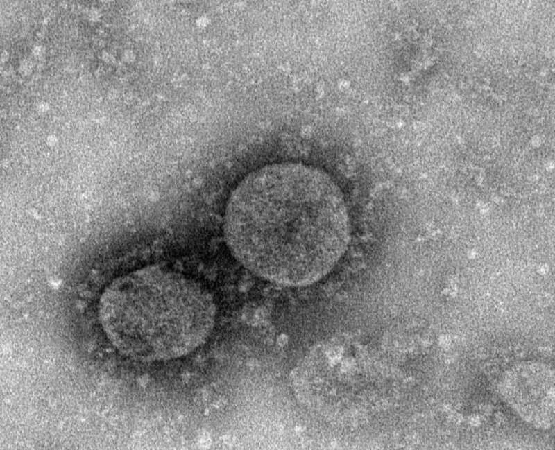 Scientists have determined the death temperature for the coronavirus