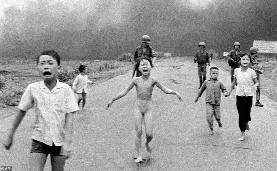 'Napalm Girl' completes skin treatment half a century after the famous photo was taken