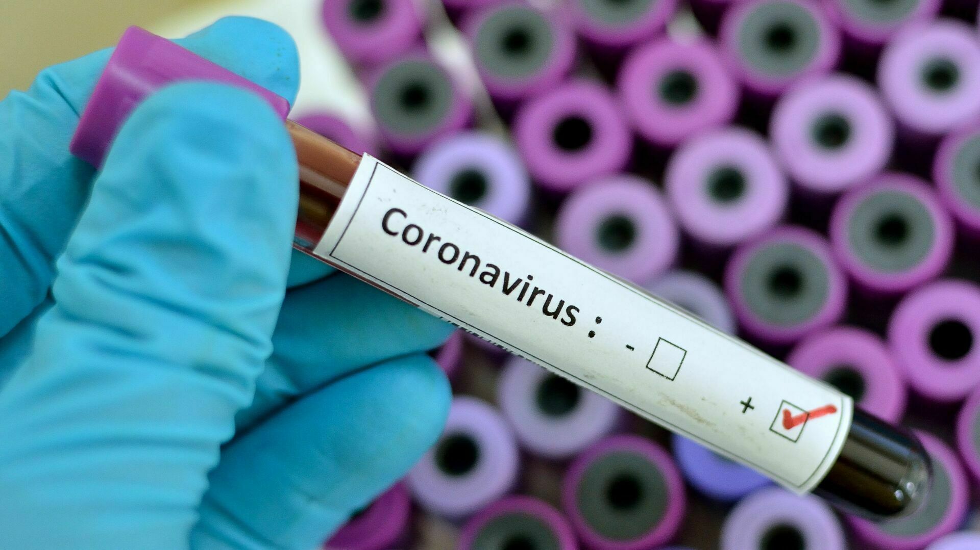 Virologists' statement: the coronavirus has become more "vile", and the death rate is growing