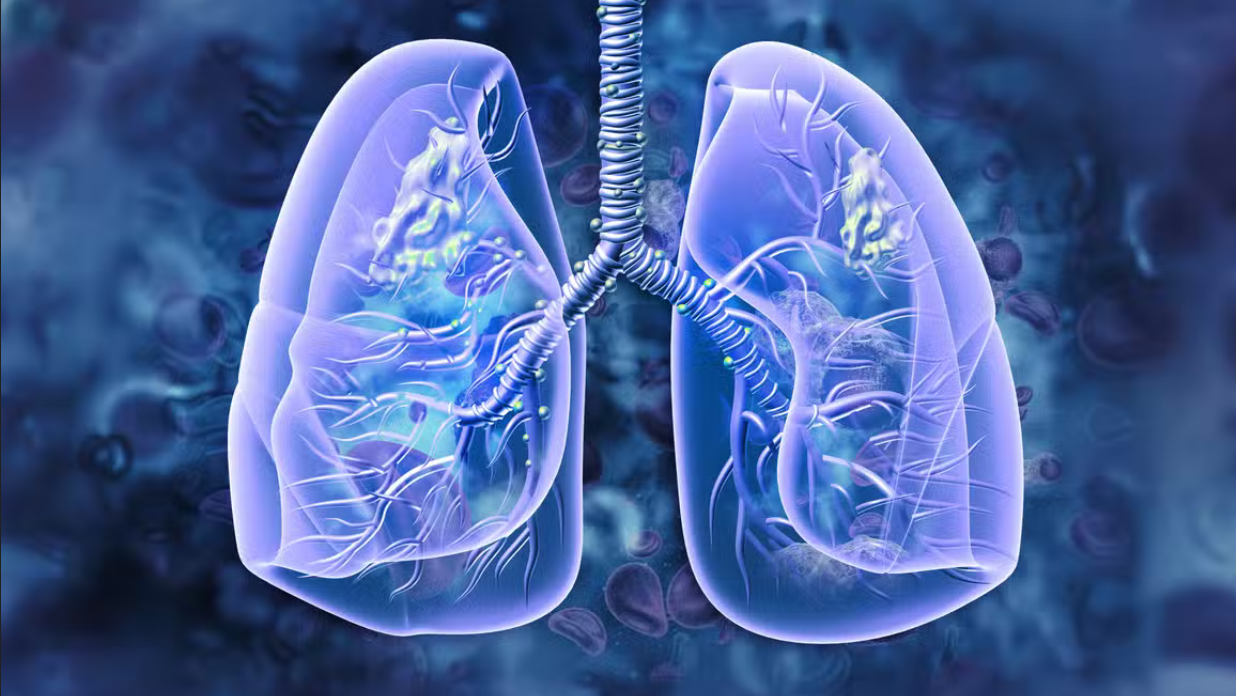 Why car pollution leads to lung cancer