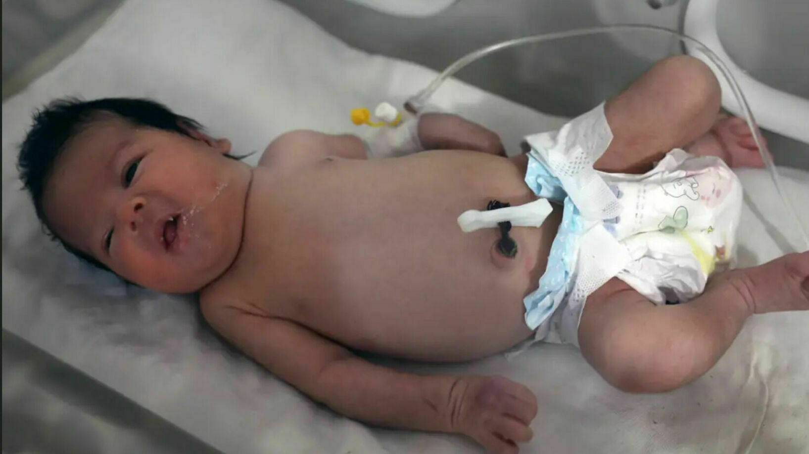 A Syrian girl born under the rubble was hidden because of the threat of abduction