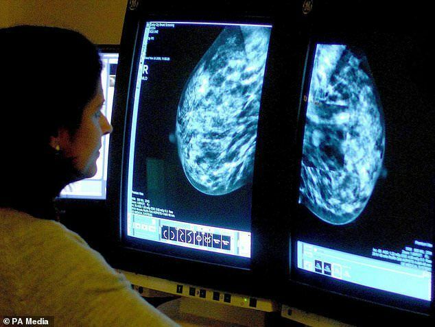WHO: breast cancer for the first time became the most common form of oncology
